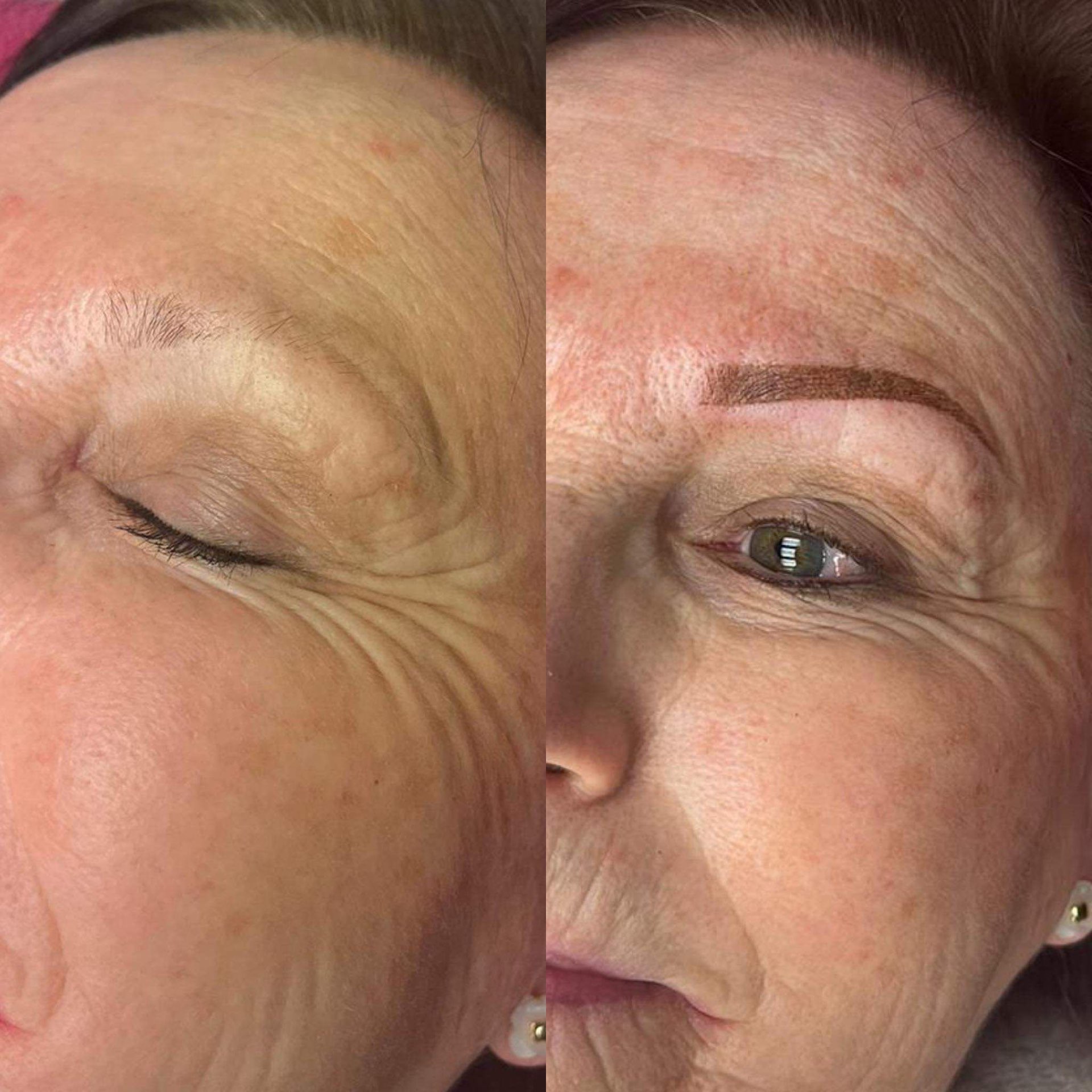 Before & after — full restoration
